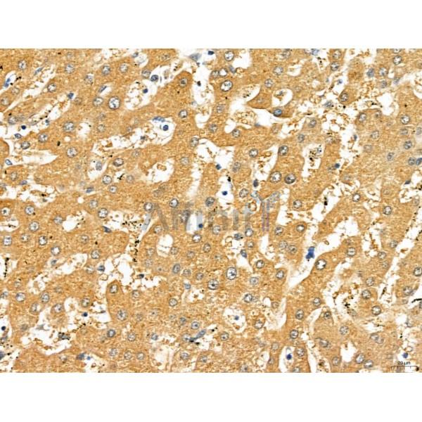 LOH12CR1 Antibody - DF13131 at 1/100 staining Human normal tissues adjacent to liver cancer by IHC-P.