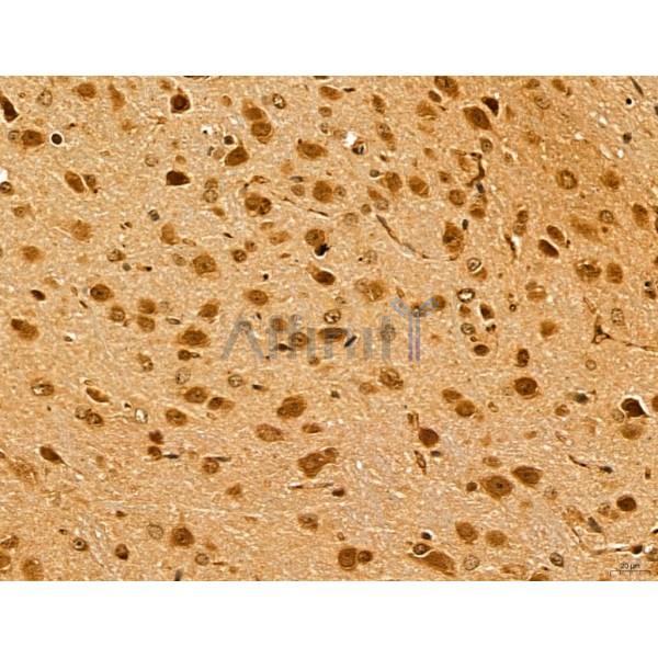 LZTFL1 Antibody - DF13134 at 1/100 staining Mouse brain tissue by IHC-P.