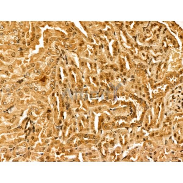 LZTFL1 Antibody - DF13134 at 1/100 staining Mouse kidney tissue by IHC-P.