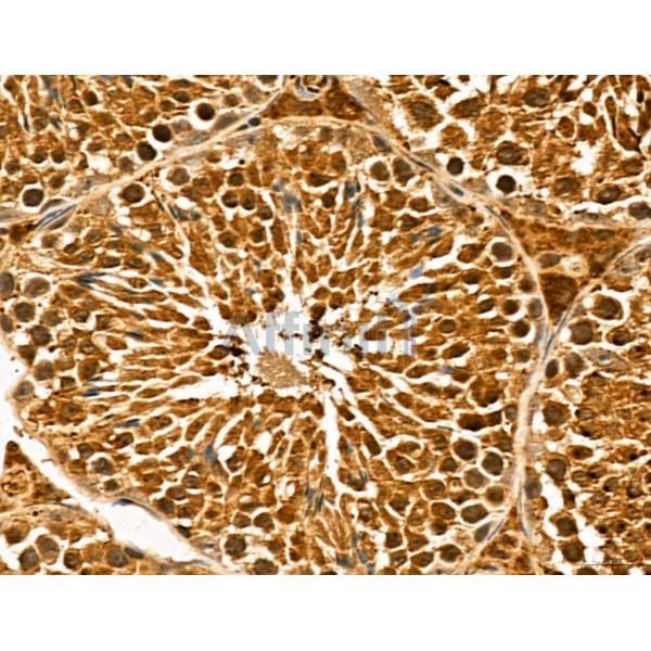 LZTFL1 Antibody - DF13134 at 1/100 staining Mouse testis tissue by IHC-P.