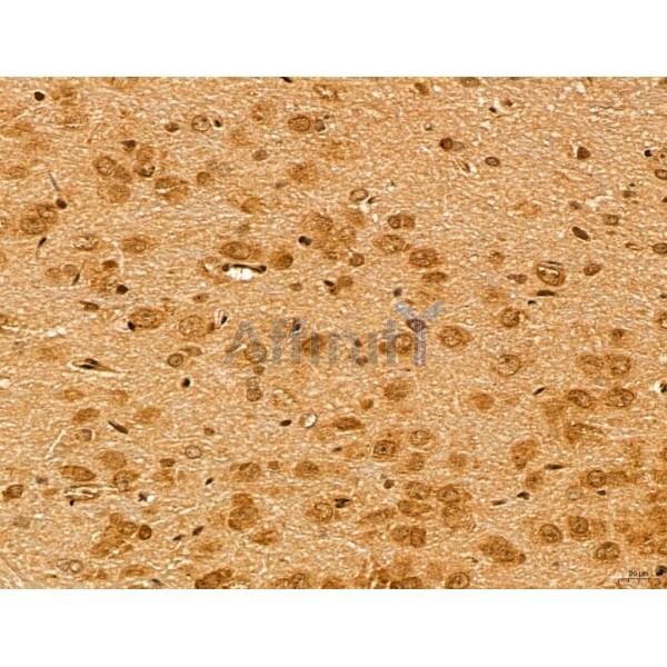 LZTFL1 Antibody - DF13134 at 1/100 staining Rat brain tissue by IHC-P.