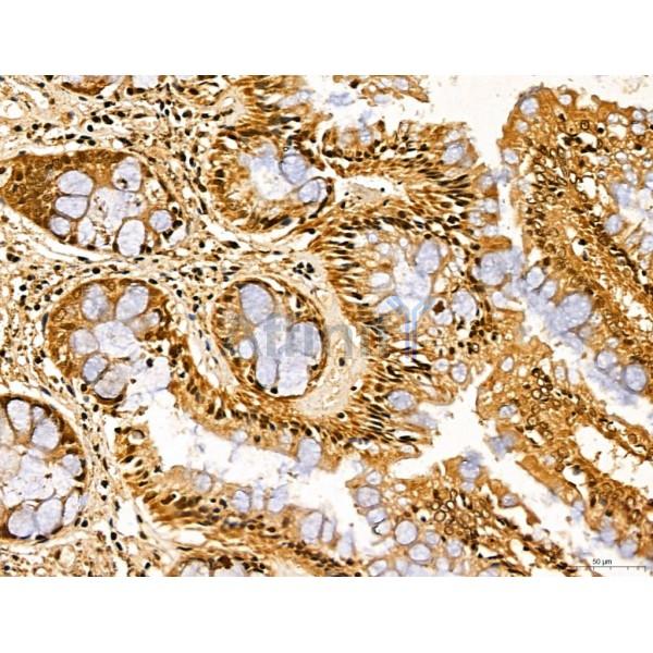 LZTFL1 Antibody - DF13134 at 1/100 staining Human normal tissues adjacent to colorectal cancer by IHC-P.