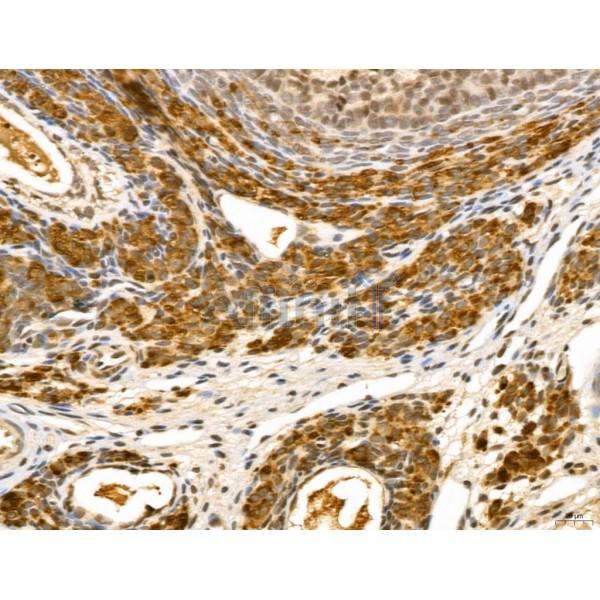 LZTFL1 Antibody - DF13134 at 1/100 staining Rat ovary tissue by IHC-P.