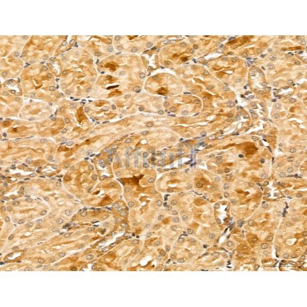 LZTFL1 Antibody - DF13134 at 1/100 staining Rat kidney tissue by IHC-P.