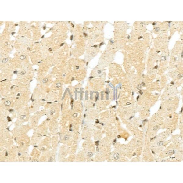 MACC1 Antibody - DF13135 at 1/100 staining Rat heart tissue by IHC-P.