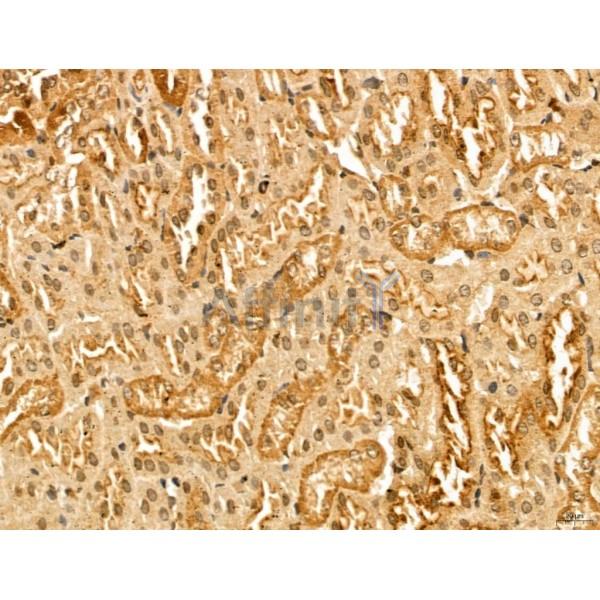 MACC1 Antibody - DF13135 at 1/100 staining Mouse kidney tissue by IHC-P.