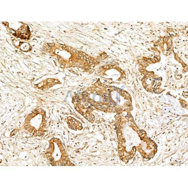 MAN1A2 Antibody - DF13136 at 1/100 staining Human normal tissues adjacent to pancreatic cancer by IHC-P.