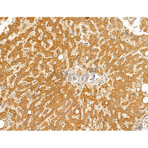 MAN1A2 Antibody - DF13136 at 1/100 staining Human normal tissues adjacent to liver cancer by IHC-P.