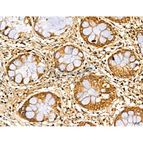 MAN1A2 Antibody - DF13136 at 1/100 staining Human normal tissues adjacent to colorectal cancer by IHC-P.