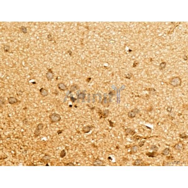 MAP1S Antibody - DF13137 at 1/100 staining Rat brain tissue by IHC-P.