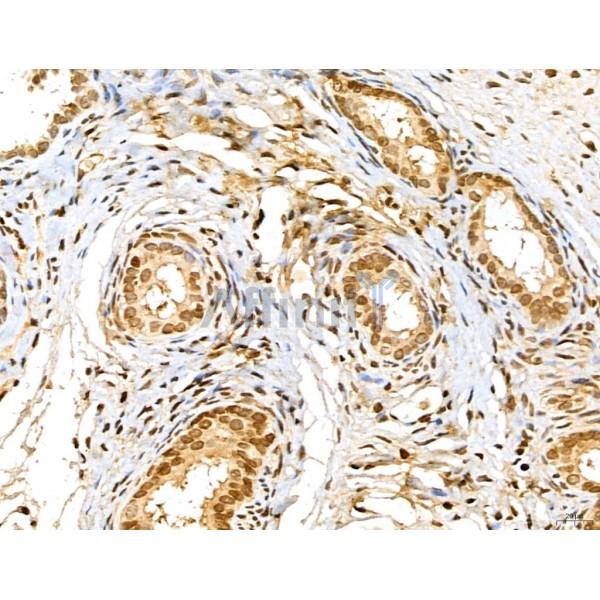 MAP1S Antibody - DF13137 at 1/100 staining Rat ovary tissue by IHC-P.