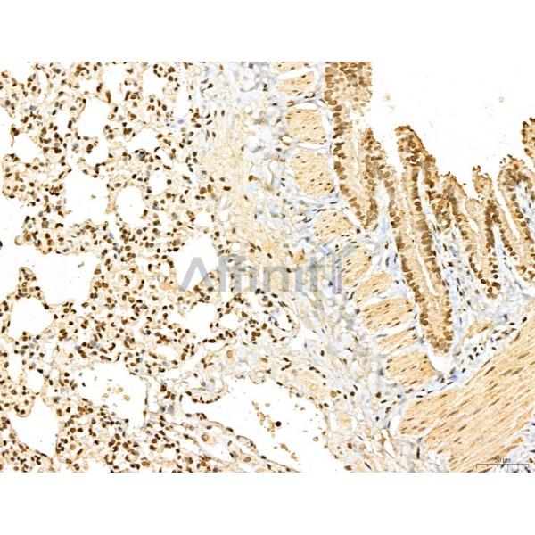 MAP1S Antibody - DF13137 at 1/100 staining Rat lung tissue by IHC-P.
