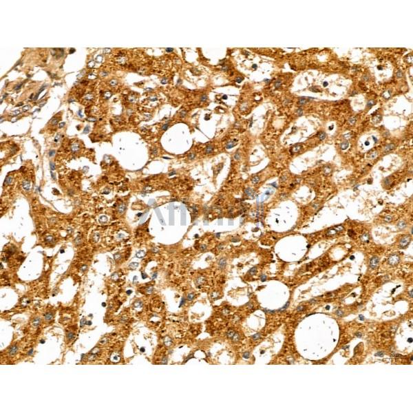 MAP1S Antibody - DF13137 at 1/100 staining Human normal tissues adjacent to liver cancer by IHC-P.