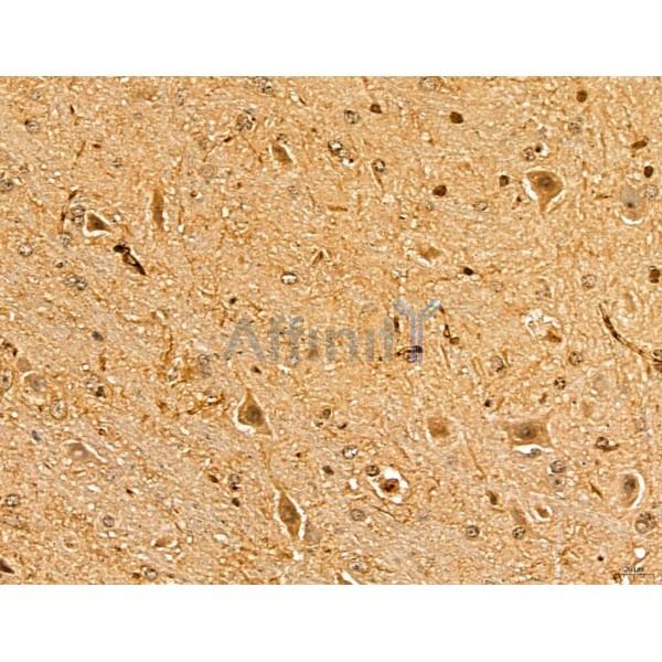 MAP1S Antibody - DF13137 at 1/100 staining Mouse brain tissue by IHC-P.