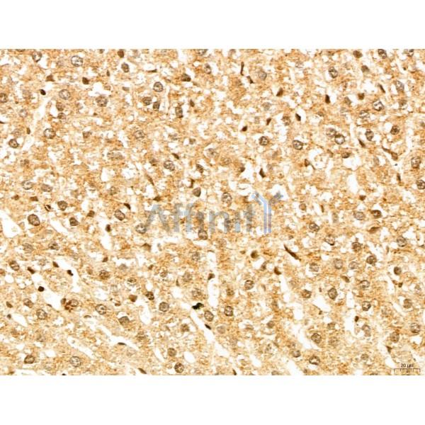 MAP1S Antibody - DF13137 at 1/100 staining Rat liver tissue by IHC-P.