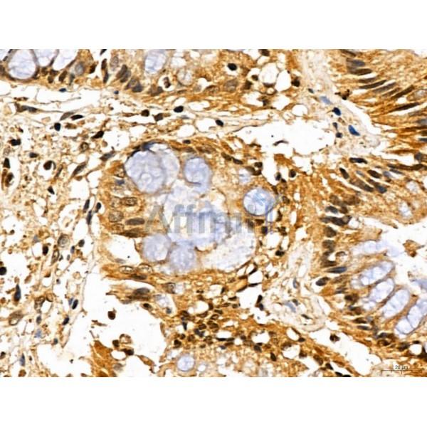 MAP1S Antibody - DF13137 at 1/100 staining Human normal tissues adjacent to colorectal cancer by IHC-P.