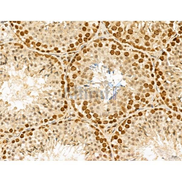 MAT2A Antibody - DF13139 at 1/100 staining Mouse testis tissue by IHC-P.