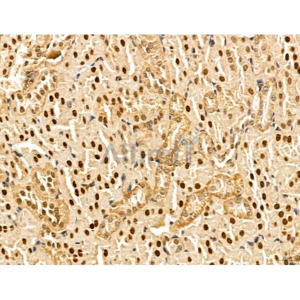 MAT2A Antibody - DF13139 at 1/100 staining Mouse kidney tissue by IHC-P.