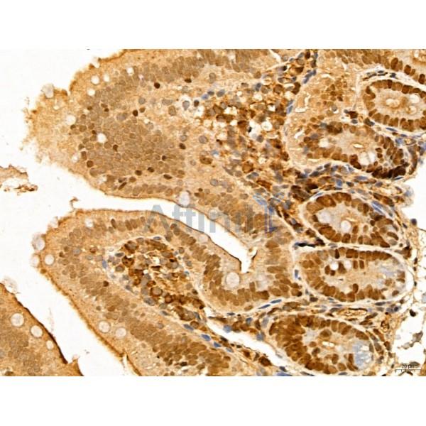 MAT2A Antibody - DF13139 at 1/100 staining Mouse colon tissue by IHC-P.