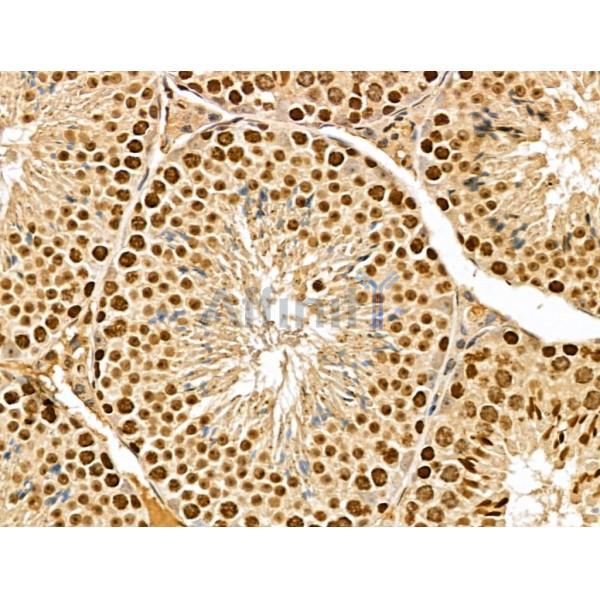 MED10 Antibody - DF13141 at 1/100 staining Mouse testis tissue by IHC-P.