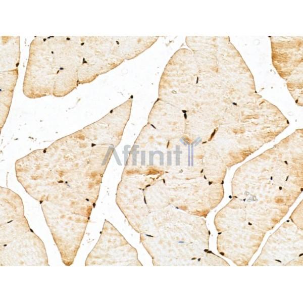 MED10 Antibody - DF13141 at 1/100 staining Mouse muscle tissue by IHC-P.