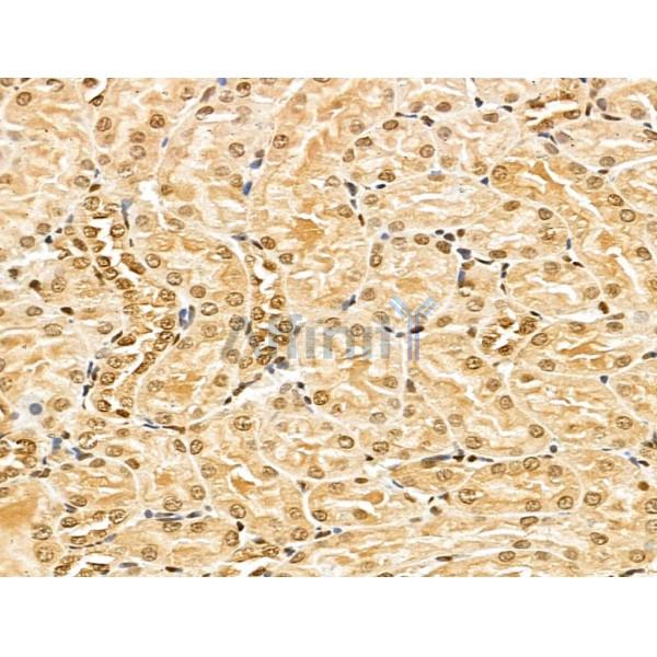 MED10 Antibody - DF13141 at 1/100 staining Rat kidney tissue by IHC-P.