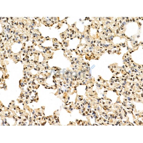 MED10 Antibody - DF13141 at 1/100 staining Rat lung tissue by IHC-P.