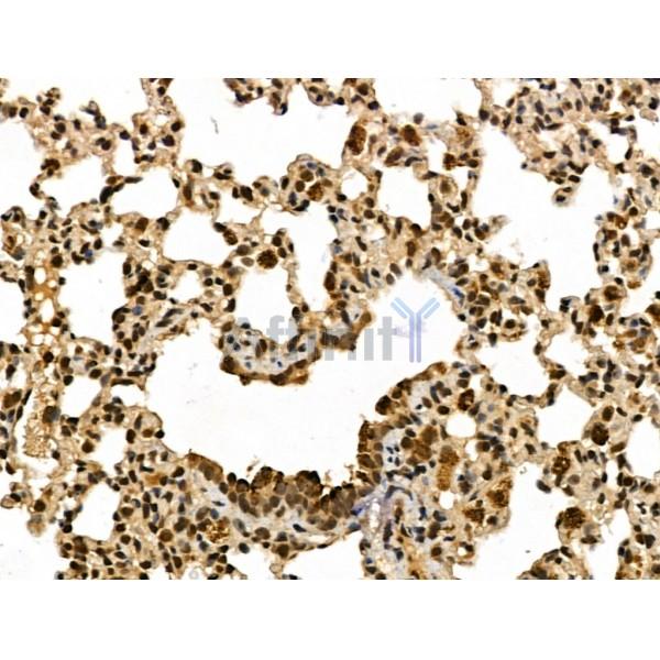 METTL1 Antibody - DF13143 at 1/100 staining Rat lung tissue by IHC-P.