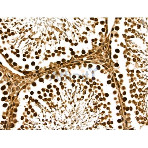 METTL6 Antibody - DF13144 at 1/100 staining Rat testis tissue by IHC-P.