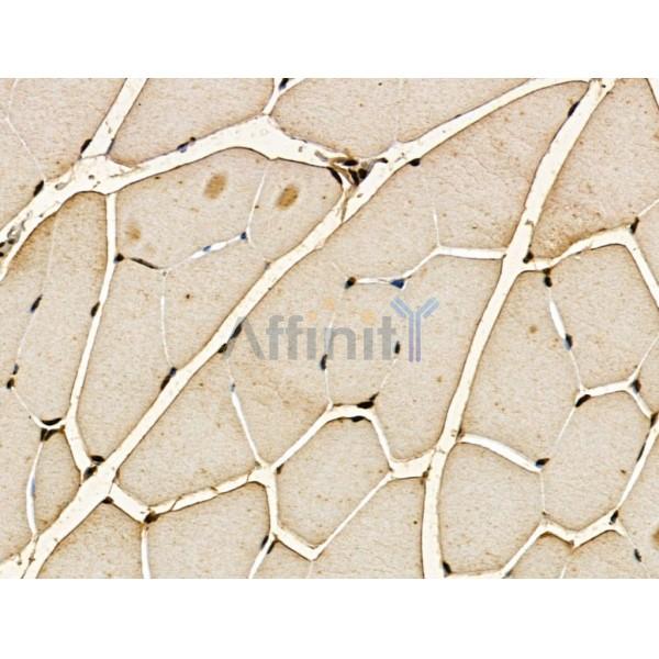 MEX3C Antibody - DF13145 at 1/100 staining Mouse muscle tissue by IHC-P.