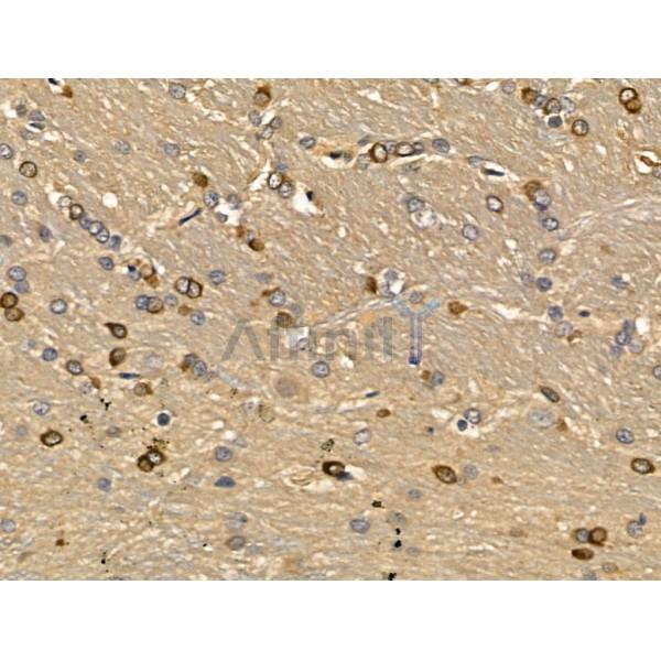 MGAT5B Antibody - DF13148 at 1/100 staining Rat brain tissue by IHC-P.