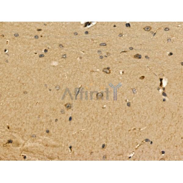 MGAT5B Antibody - DF13148 at 1/100 staining Mouse brain tissue by IHC-P.