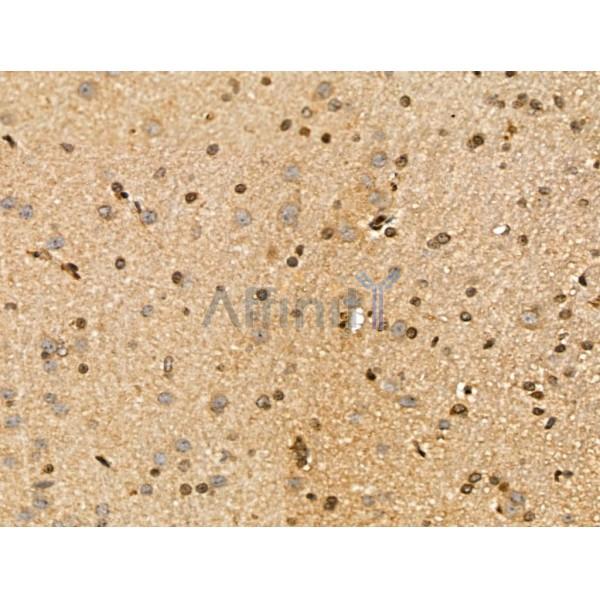MICAL2 Antibody - DF13149 at 1/100 staining Rat brain tissue by IHC-P.