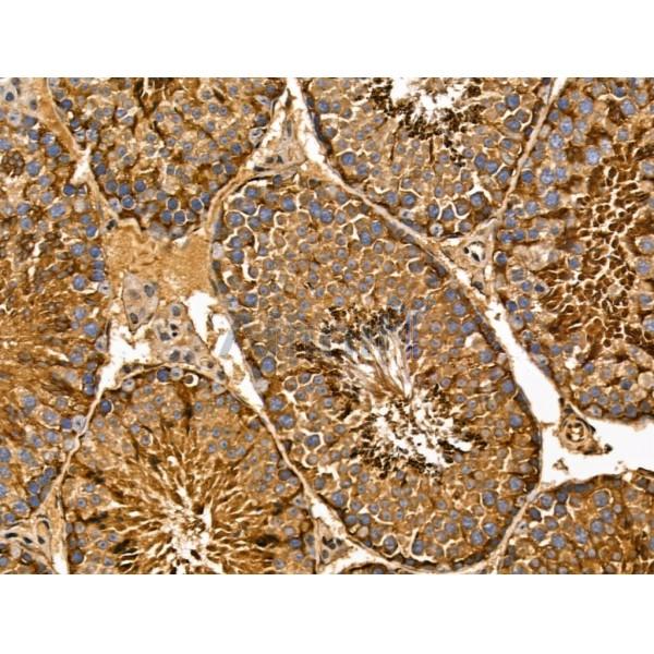 MIPEP Antibody - DF13151 at 1/100 staining Mouse testis tissue by IHC-P.