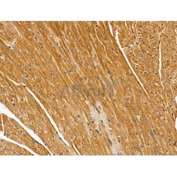 MIPEP Antibody - DF13151 at 1/100 staining Mouse heart tissue by IHC-P.