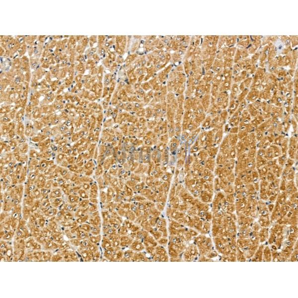 MIPEP Antibody - DF13151 at 1/100 staining Rat heart tissue by IHC-P.