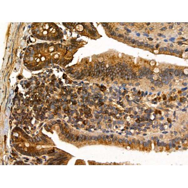 MLK2 Antibody - DF13152 at 1/100 staining Mouse colon tissue by IHC-P.