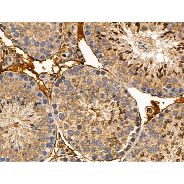 MLK2 Antibody - DF13152 at 1/100 staining Mouse testis tissue by IHC-P.