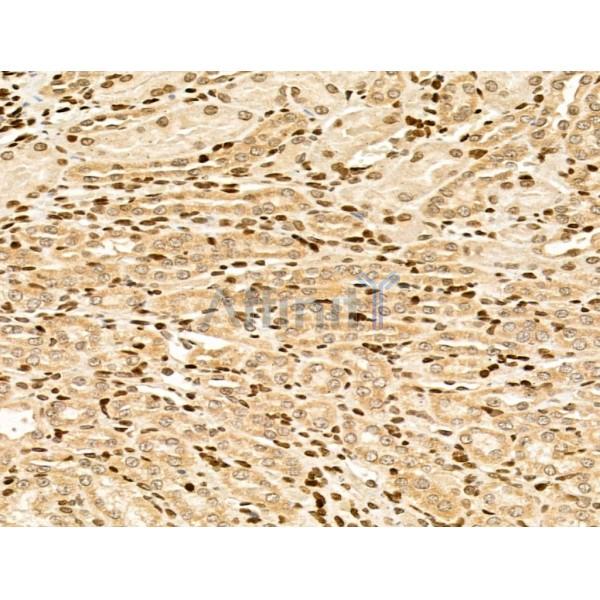 MYO1E Antibody - DF13167 at 1/100 staining Rat kidney tissue by IHC-P.