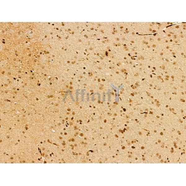 MYO1E Antibody - DF13167 at 1/100 staining Mouse brain tissue by IHC-P.