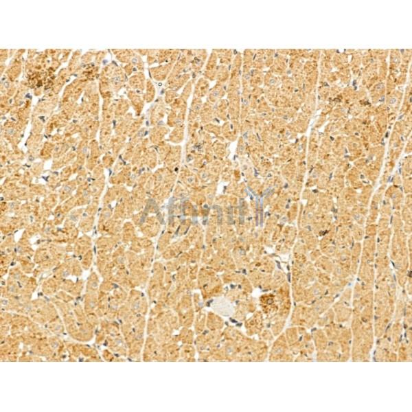 Myoferlin Antibody - DF13168 at 1/100 staining Rat heart tissue by IHC-P.
