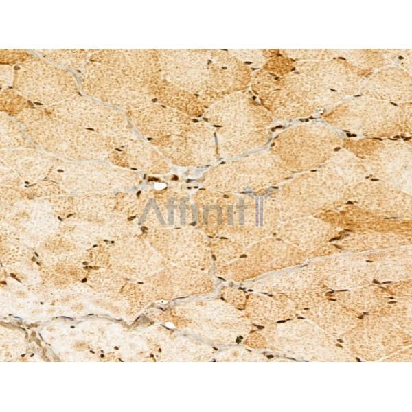 Myoferlin Antibody - DF13168 at 1/100 staining Rat skin tissue by IHC-P.