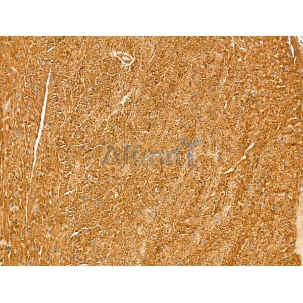 Myoferlin Antibody - DF13168 at 1/100 staining Mouse heart tissue by IHC-P.
