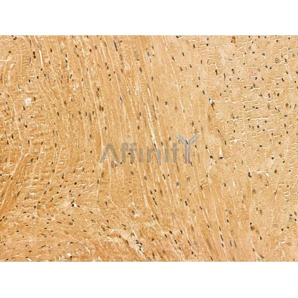 MYOM3 Antibody - DF13170 at 1/100 staining Mouse heart tissue by IHC-P.