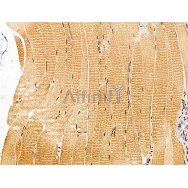 NAP1L4 Antibody - DF13174 at 1/100 staining Rat muscle tissue by IHC-P.