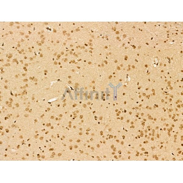 NCOA6 Antibody - DF13176 at 1/100 staining Rat brain tissue by IHC-P.