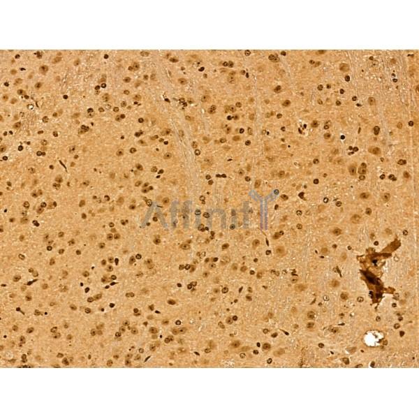NCOA6 Antibody - DF13176 at 1/100 staining Mouse brain tissue by IHC-P.