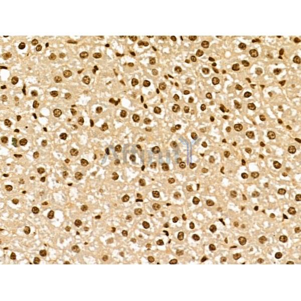 NCOA6 Antibody - DF13176 at 1/100 staining Rat liver tissue by IHC-P.