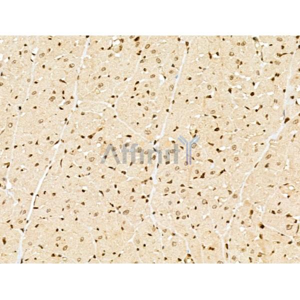 NCOA6 Antibody - DF13176 at 1/100 staining Rat heart tissue by IHC-P.
