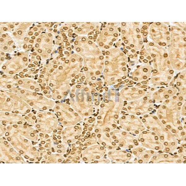 NCOA6 Antibody - DF13176 at 1/100 staining Rat kidney tissue by IHC-P.